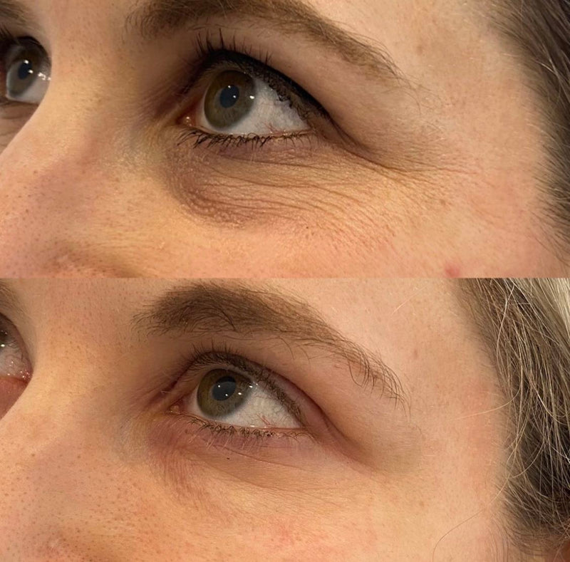 Visibly smoothed fine lines